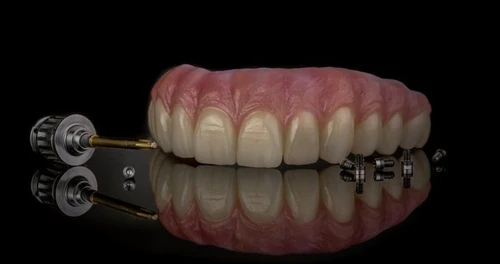 Full upper dental implant prosthesis with screws and tools on black reflective surface.